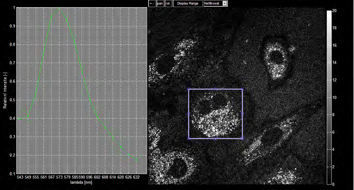 8.5. Funkce pro analýzu snímků ve 2D Menu pro analýzu se zobrazují vždy vlevo vedle zobrazovací plochy nad tlačítkem Parametry Snímků.