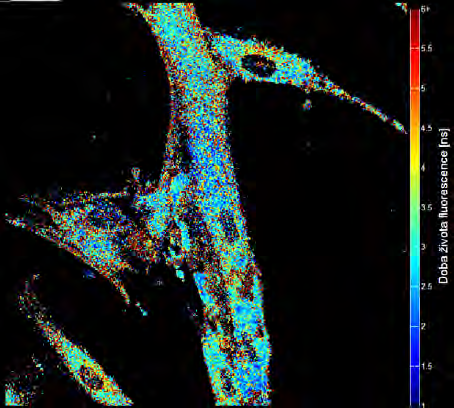 znázorňujícího dobu života fluorescence tohoto řezu.