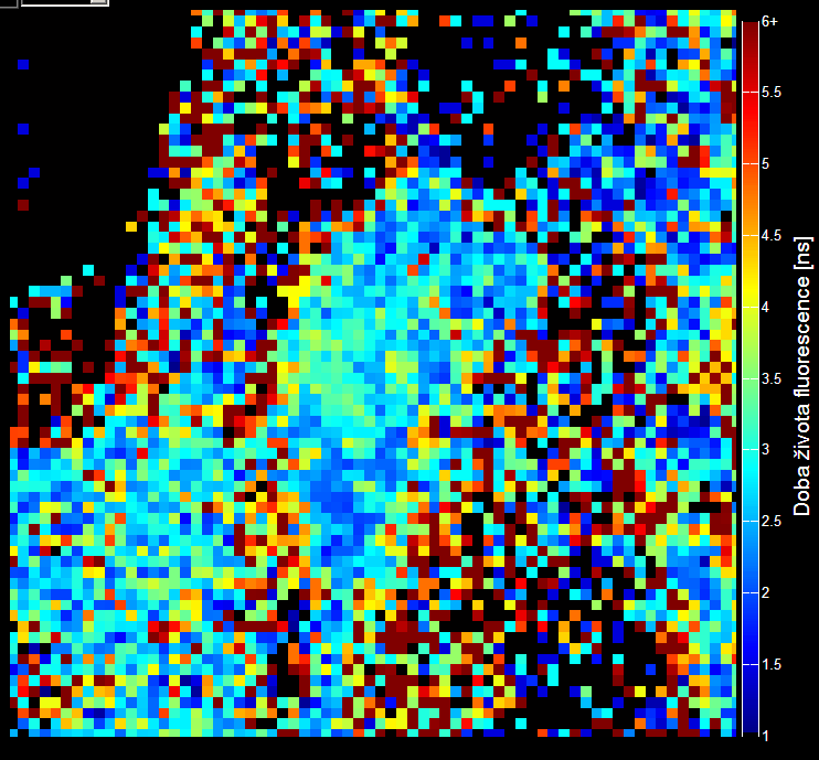 Snímek znázorňující dobu života fluorescence [ns] vpravo Obr. 72 Detail snímku.