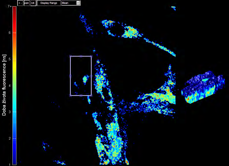 Obr. 73 Fibroblasty. Výběr oblasti a 3D zobrazení doby života fluorescence [ns] Obr. 74 Fibroblasty 3D.