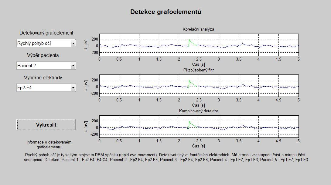 je pojem Handle, což je proměnná, která jednoznačně identifikuje každý grafický objekt a pomocí ní jsou informace o grafických objektech předávány mezi funkcemi [20].