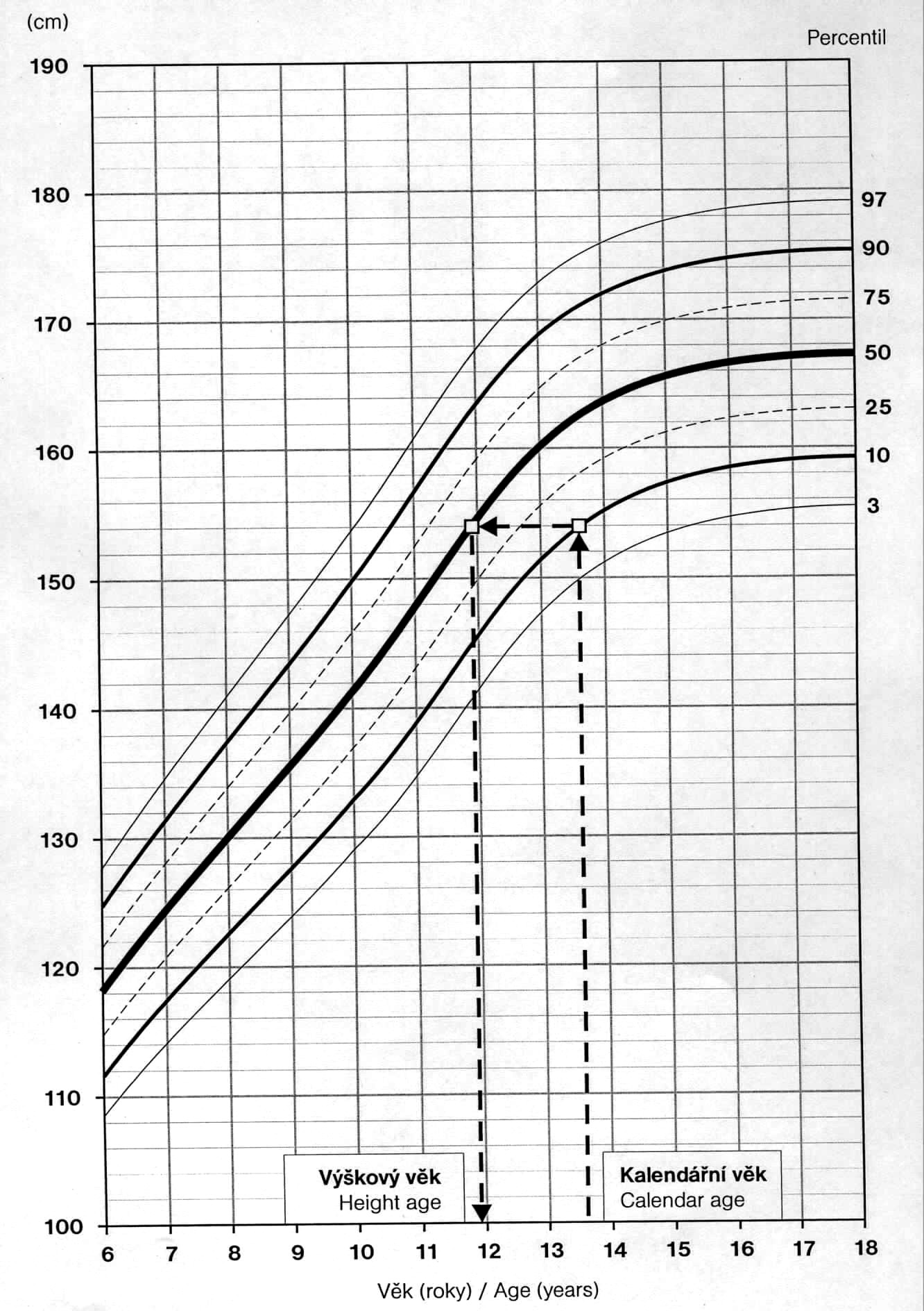 Obr. 11: Princip odečtu výškového věku z percentilového grafu tělesné výšky (upraveno podle Vignerová et al., 2006).