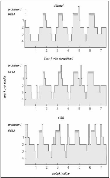 Obr. 2: Cykly spánkových fází u různých věkových skupin (Smolík, 2002; převzato z Roche Seminars on Aging: Aging in Sleep.