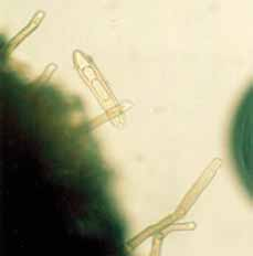 ), Fusarium spp., Pyrenophora tritici-repentis (Drechslera tritici repentis), popř. s příznaky nedostatku hořčíku aj.