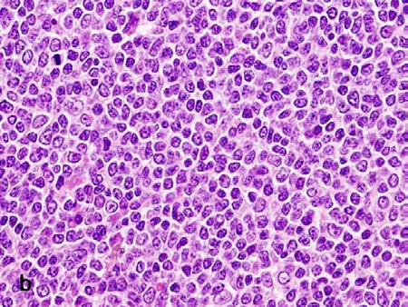 hvězdné nebe (a), v detailu (b) v barvení hematoxylin-eosin