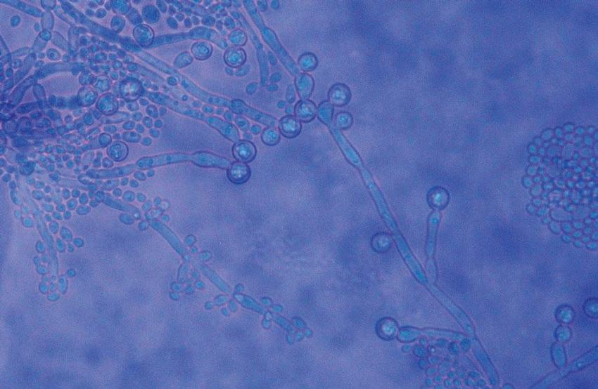 pozorování tvorby chlamydospor rýžový agar a kukuřičný agar obohacený o Tween 80. (Rosenthal a Furnari 1959) Obrázek 2: Tvorba chlamydospor C.