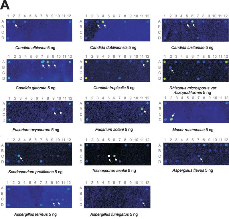 křivky tání. Záznam amplifikace se provádí pomocí fluorescence sond navázaných na nově vznikající DNA. (Susanne Gebert et al. 2008; Wellinghausen et al.