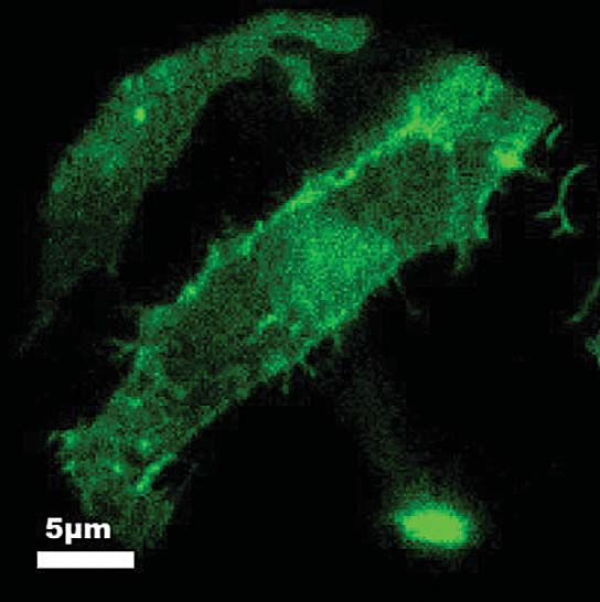 microscope (ILM).