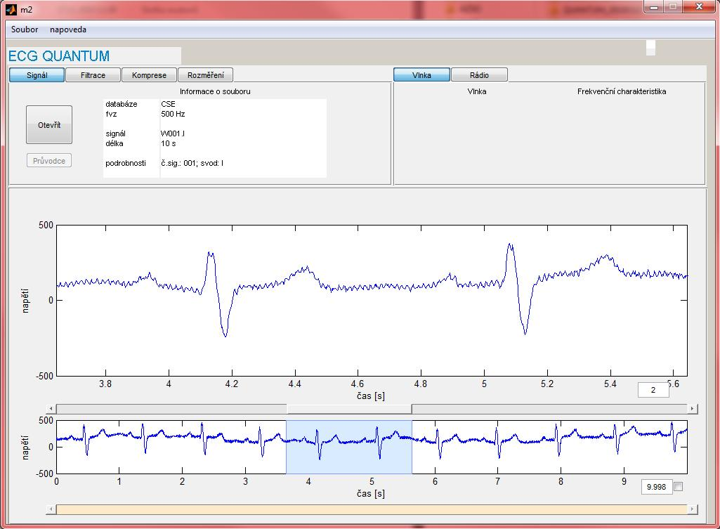 Obr..: Software EKG Kvantum, panel Signál.