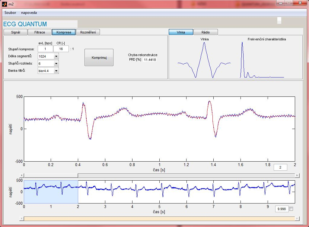 Obr..3: Software EKG