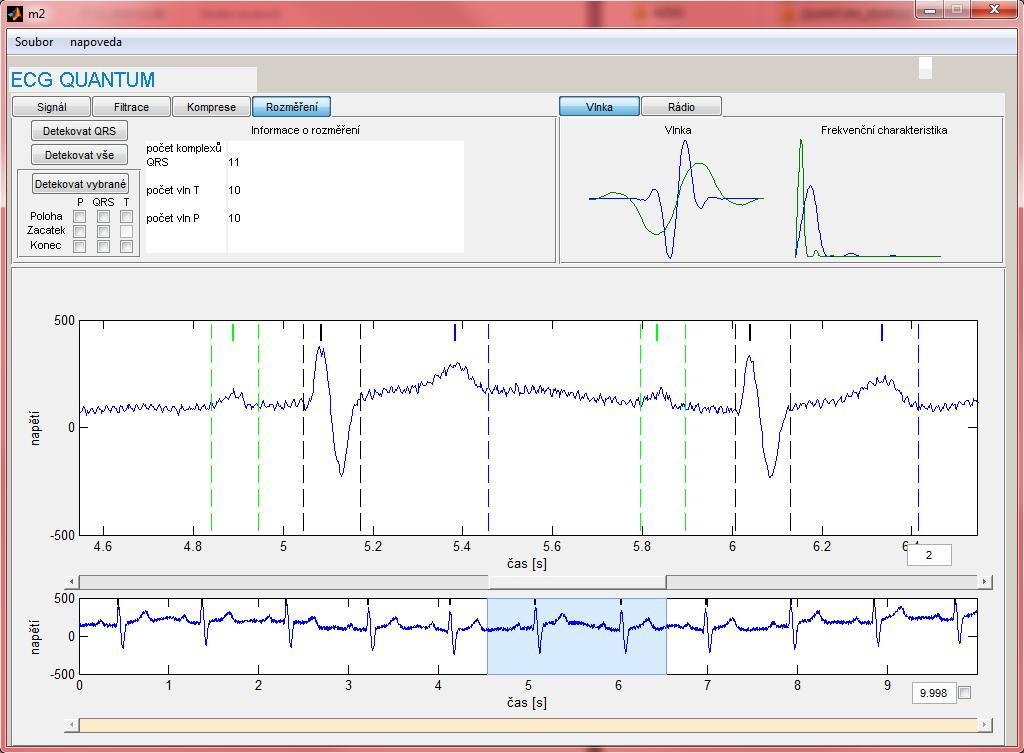 Obr..4: Software EKG