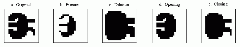 2.4 Metody založené na segmentaci 23 Dilatace (dilatation) je opačná operace k erozi při které kernel spolu se stanoveným kotevním bodem (většinou střed kernelu) posouván skrze obrázek.