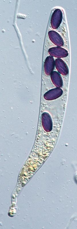 ASCOMYCOTA ZÁKLADNÍ CHARAKTERISTIKA Největší skupina říše Fungi (kolem 3 500 rodů a 33 000 druhů). Velká morfologická i ekologická rozmanitost a s tím rozsáhlá terminologie.