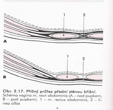 o oblast pupku: vv. paraumbilicales podél lig. teres hepatis do v. portae ztížený průtok krve játry = městnání krve ve v. portae - v okolí pupku caput medusae - a. epigastrica superficialis, a.