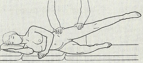 Obr. 24. Test m. gluteus medius et minimus [RYCHLÍKOVÁ, 2004, s. 169] Přímý sval břišní (m. rectus abdominis) v týl.