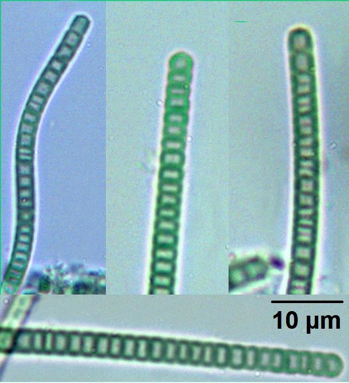 Příloha 6: Candidatus Motykia elegans gen. et sp. nov. (Jahodářová) E1, candidatus Motykia elegans gen. et sp. nov. (Jahodářová) E8, candidatus Motykia elegans gen.