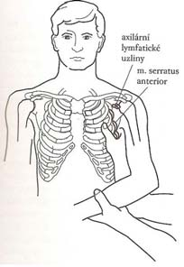 požádáme, aby se vyhrbil a zatlačil ramena dopředu, přitom přejíždíme prsty kraniokaudálně od druhého žebra ve střední axilární čáře, kde jsou pohmatu přístupné svalové snopce (obr. 43).