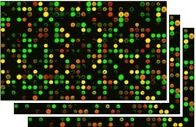 Microarray dosud neprověřená kvalita Nevýhody Omezený počet publikací pro vyšší gestační týdny 3 Zatím chybí porovnání klinických výstupů 1 Taneja et al.