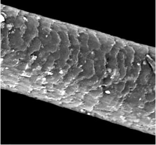 Obr. : Kutikula lidského vlasu (SEM). Obr. : Ruptury kutikuly vlasů (SEM). Kůra (cortex) je nejmohutnější součástí lidského vlasu.tvoří ji vřetenovité, zrohovatělé buňky.