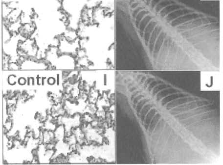 (B) X-ray image showing a diffuse shadow in both lungs, mainly around the hilus regions, indicative of neurogenic pulmonary edema in a rat anesthetized with 1.5% isoflu rane.