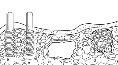 3.1.3. Dělení biomateriálů dle reakce s živou tkání Dělení podle reakce s živou tkání Různé tělní systémy (např.