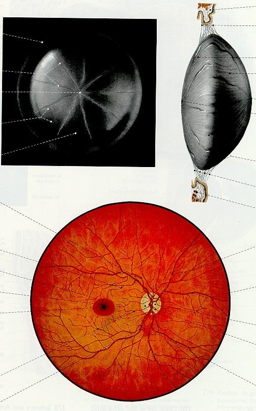 Lens crystalina čočka