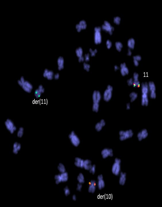 Partnerský chromosom morfologicky neodpovídal alterovanému chromosomu 2, ale zdánlivě normálnímu chromosomu 10.