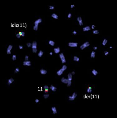 2 11qter. FISH se sondami RP11-450F4 (11p11.2) a CEP 11 (11p11.