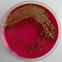 UTB ve Zlíně, Fakulta technologická 43 příliš vhodný, jelikož zde mohou růst další bakterie, které nepatří do čeledi Enterobacteriaceae, například grampozitivní bakterie jako jsou enterokoky a
