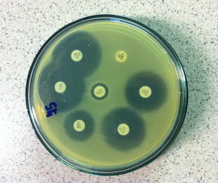 UTB ve Zlíně, Fakulta technologická 67 Obr. 5. Mueller-Hinton agar s antibiotickými disky, kmen 75.