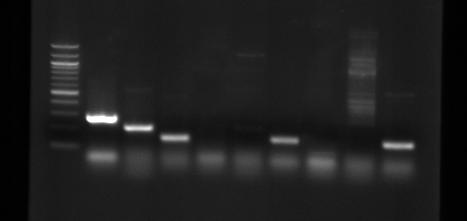 UTB ve Zlíně, Fakulta technologická 78 Obr. 7 Agarózový gel s PCR produkty. Zleva: 1. jamka marker (100 bp), 2. jamka- pozitivní gen chua (279 bp), 3. jamka- pozitivní gen yjaa (211 bp), 4.