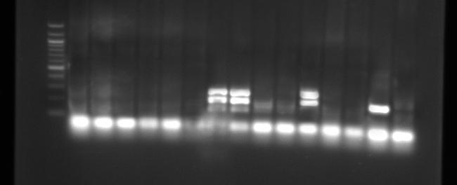 jamka- negativní gen yjaa (211 bp), 10. jamka- pozitivní gen TspE4C2 (152 bp). Jamka 2-4 vzorek 43, jamka 5-7 vzorek 33, jamka 8-10 vzorek 34. Obr. 8 Agarózový gel s PCR produkty. Zleva: 1.