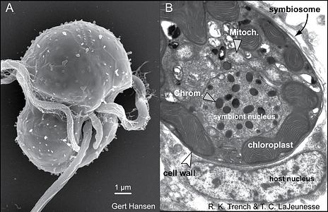 korálové útesy Symbiotické zooxantely obrněnky rodu Symbiodinium vnitrobuněční symbionti v endodermu žahavců