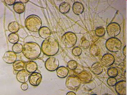 rostlinných buněk, kde vytváří větvené keříčkovité útvary (arbuskuly) a často i měchýřky (vezikuly) tvoří ji cca 95%