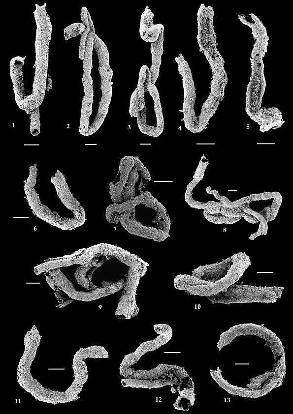 Délka měřítka je 100 µm.