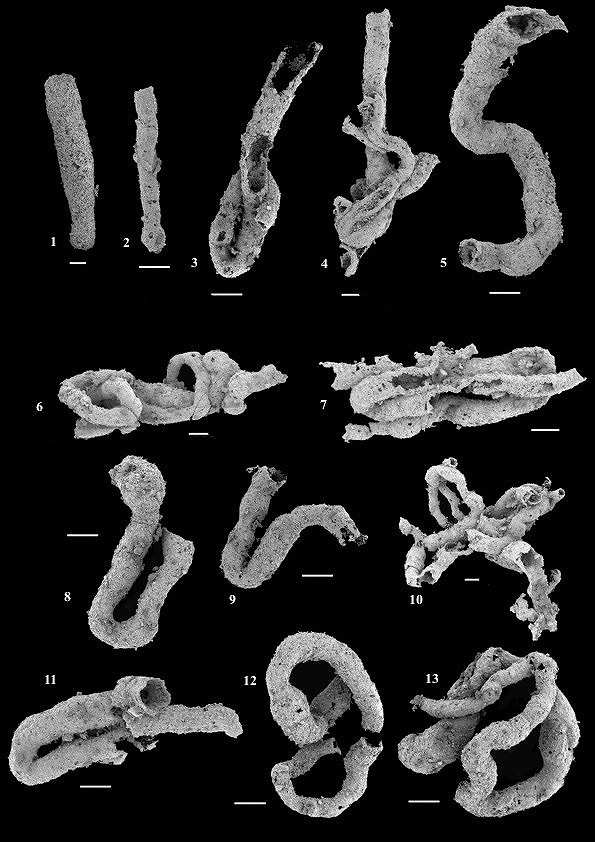 Délka měřítka je 100 µm.