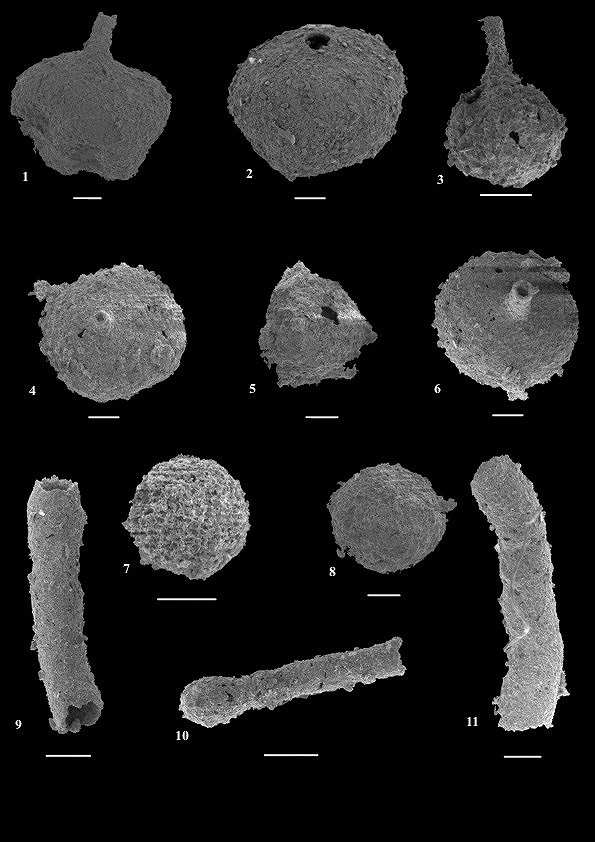 Délka měřítka je 100 µm.