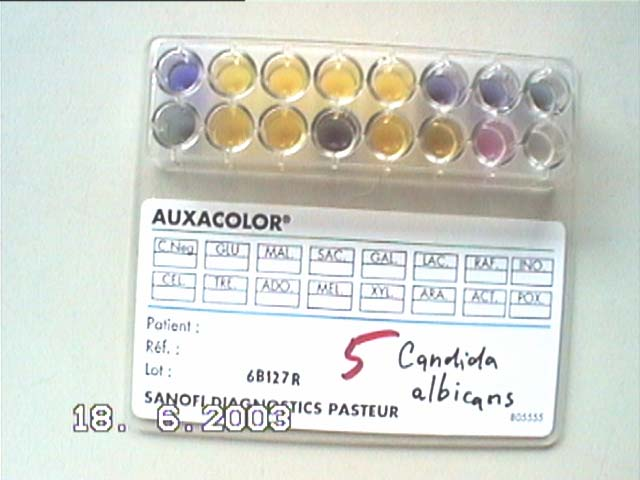 Kvasinky Test Auxacolor je obdobou pestré řady cukrů u bakterií.