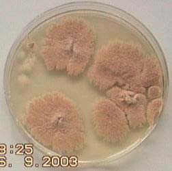 Oportunní hyfomycety Scopulariopsis brevicaulis charakteristika Keratinofilní
