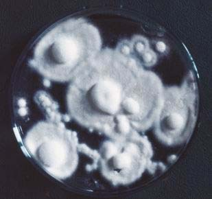 Trichophyton rubrum - charakteristika druhu U nás