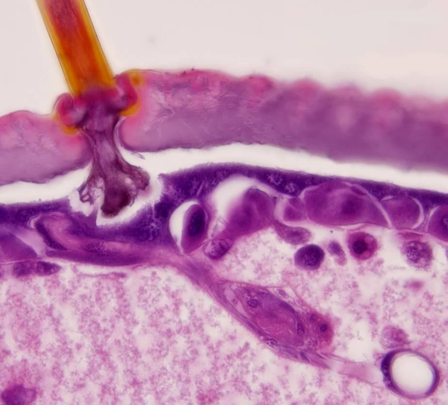 cytoplasma růžová eozinem senzila larvy