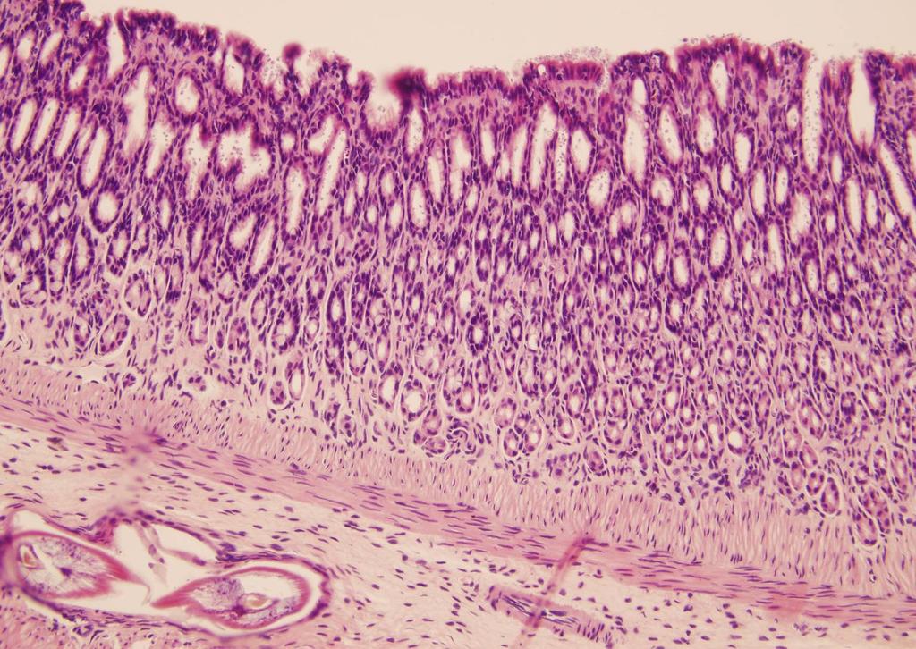 Cryptosporidium