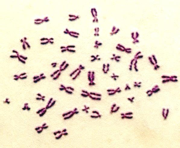 EUKARYOTA BUNĚČNÉ ORGANELY Jádro Jaderná membrána fosfolipidová dvojvrstva, póry Jaderná DNA + proteiny histonového a nehistonového