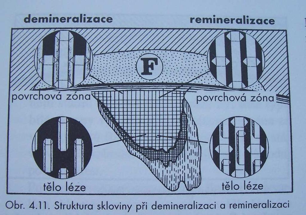 kazu Zdroj: Kilián, 1999. s. 45 Obr.