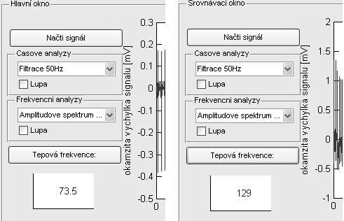 Obr.33 Automatická detekce tepové frekvence výřez v programu. Vlevo před, vpravo po zátěži. K automatické detekci tepové frekvence byl plně využit algoritmus z kapitoly 6.8.
