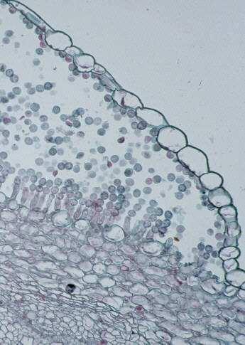 Albugo candida Č: Albuginaceae Albugo candida Intercelulární mycelium tvoří agregáty pod hostitelskou epidermis a na něm vzrůstají palisádovitě uspořádané sporangiofóry se sferickými sporangiemi