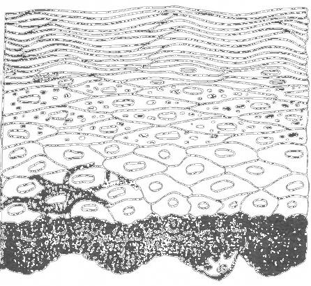 POKOŢKA (EPIDERMIS) Stratum corneum Stratum