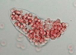 Plasmodium