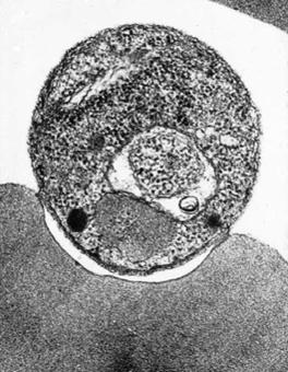 Naegleria fowleri