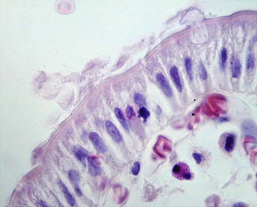 c. DUODENÁLNÍ BIOPSIE (často